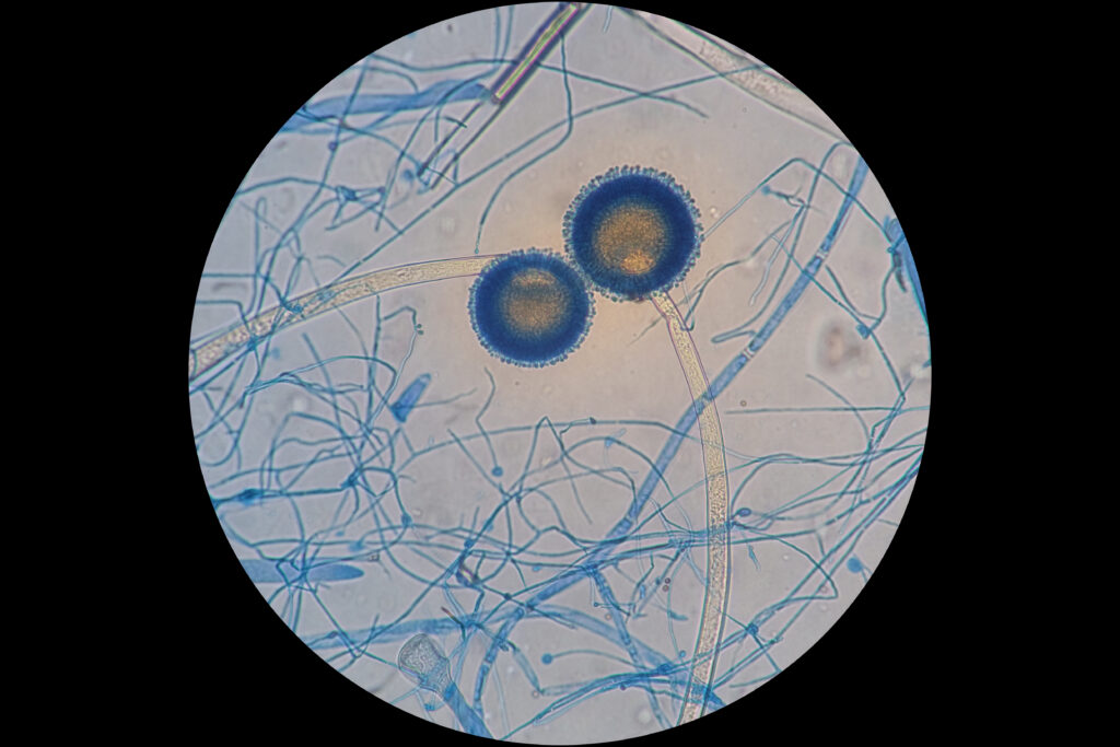 WHO has recently identified Aspergillus fumigatus as one of the life-threatening fungal pathogens. 3 shutterstock 2030840519